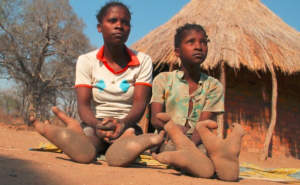 تصاویر/ قبایل آفریقایی با پاهای عجیب