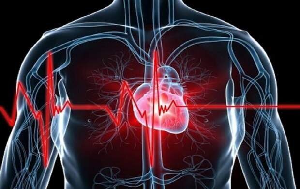 حمله قلبی | علائم حمله قلبی