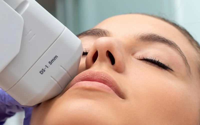 What is hifu face and how long does it last?