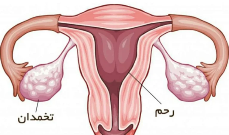 5 روش تضمینی تقویت تخمدان و بارداری سریع