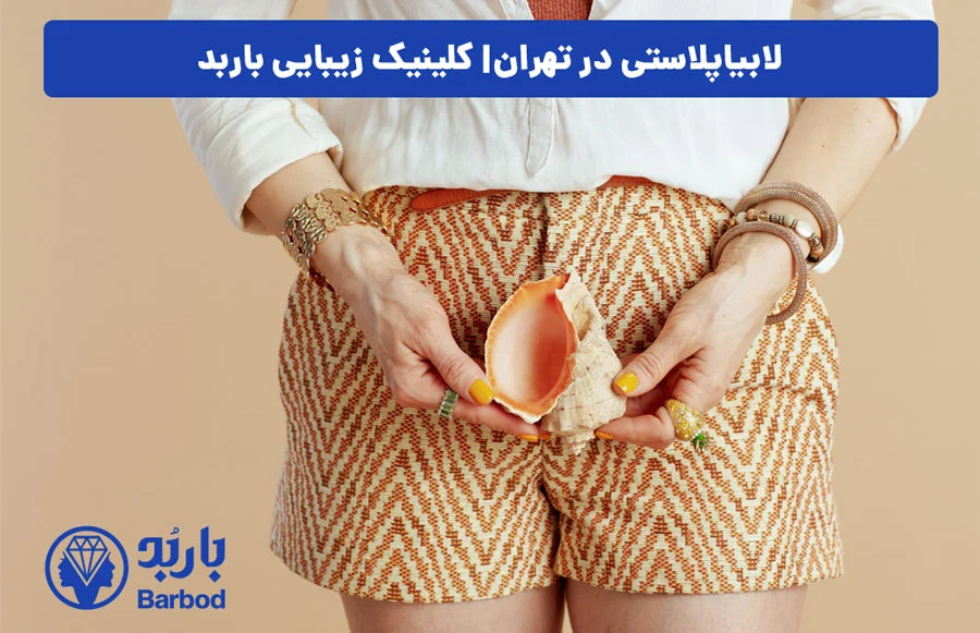 اپل | تهران
