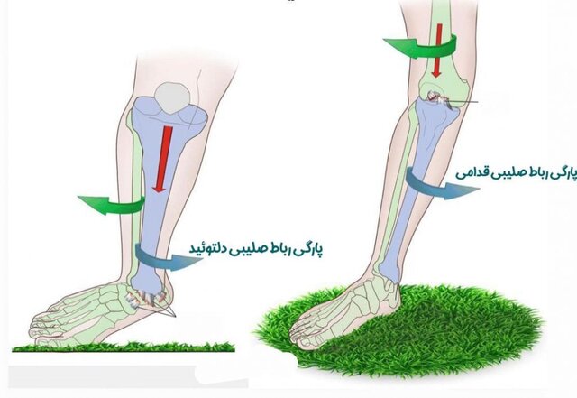 زانو؛ پیچیده ترین و آسیب پذیرترین مفصل بدن