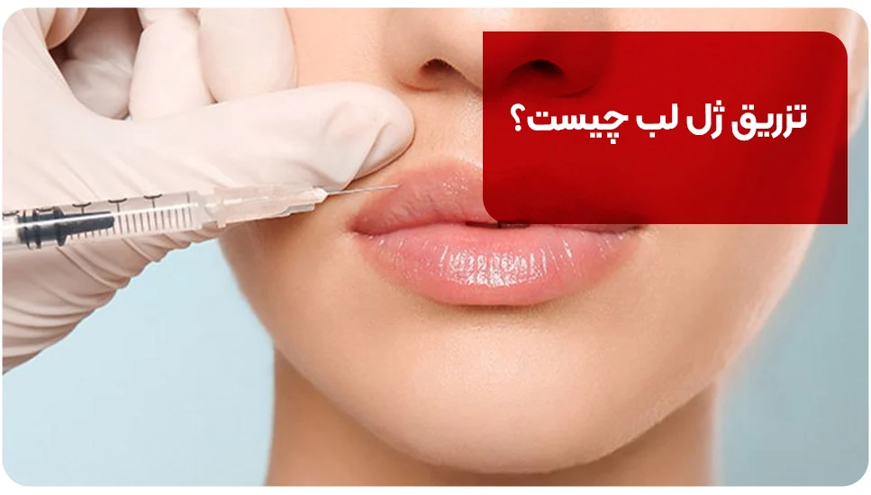 تزریق ژل لب چیست؟