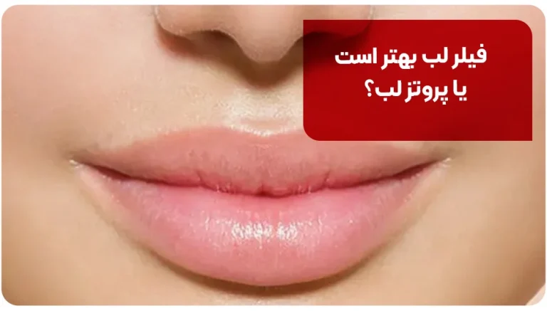 فیلر لب بهتر است یا پروتز لب؟