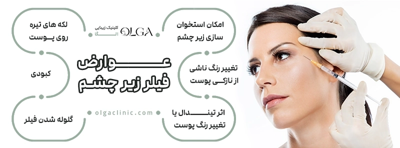 عوارض فیلر زیر چشم